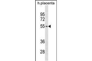 TARBP2 Antibody (N-term) ABIN2846967 western blot analysis in human placenta tissue lysates (35 μg/lane). (TARBP2 antibody  (N-Term))