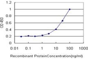 Detection limit for recombinant GST tagged CBR1 is approximately 1ng/ml as a capture antibody. (CBR1 antibody  (AA 1-277))