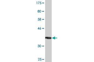 Western Blot detection against Immunogen (37. (NUAK2 antibody  (AA 521-628))