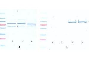 Western Blotting (WB) image for anti-V-Akt Murine Thymoma Viral Oncogene Homolog 1 (AKT1) (Ser473) antibody (ABIN400784) (AKT1 antibody  (Ser473))
