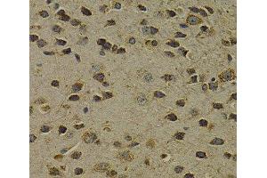 Immunohistochemistry of paraffin-embedded Mouse brain using OGG1 Polyclonal Antibody at dilution of 1:200 (40x lens). (OGG1 antibody)