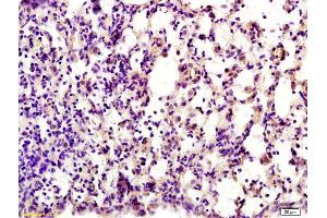 Formalin-fixed and paraffin embedded rat lung labeled with Rabbit Anti HSD3B7 Polyclonal Antibody, Unconjugated (ABIN680018) at 1:200 followed by conjugation to the secondary antibody and DAB staining (HSD3B7 antibody  (AA 281-369))