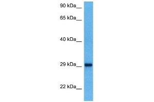 Host:  Mouse  Target Name:  YWHAQ  Sample Tissue:  Mouse Kidney  Antibody Dilution:  1ug/ml (14-3-3 theta antibody  (N-Term))