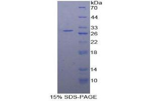 SDS-PAGE (SDS) image for Protein Kinase D2 (PKD2) (AA 621-832) protein (His tag) (ABIN2126515) (PKD2 Protein (AA 621-832) (His tag))