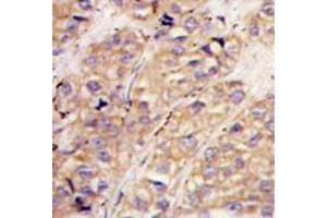 Image no. 3 for anti-SMAD Specific E3 Ubiquitin Protein Ligase 1 (SMURF1) (N-Term) antibody (ABIN357469) (SMURF1 antibody  (N-Term))