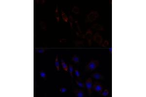 Immunofluorescence analysis of L929 cells using RNF112 antibody (ABIN7270054) at dilution of 1:100.