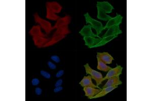 ABIN6261753 and ABIN6276862 staining Hela cells(30 min of UV treatment) by IF/ICC.
