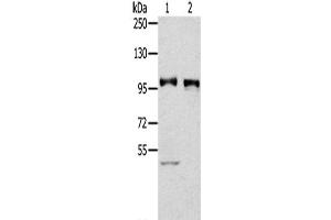Western Blot analysis of Human fetal liver tissue and 231 cells using PROX1 Polyclonal Antibody at dilution of 1/300
