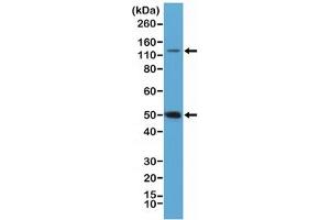 Western blot testing of HeLa cell lysate with recombinant NFKB1 antibody at 1:100 dilution.