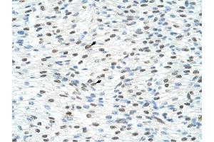 Matrin 3 antibody was used for immunohistochemistry at a concentration of 4-8 ug/ml to stain Myocardial cells (arrows) in Human Heart. (MATR3 antibody  (N-Term))
