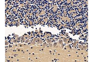 ABIN7094065 and ABIN7098109 at 1/100 staining mouse brain tissue by IHC-P.