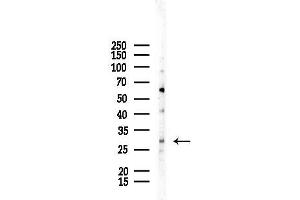 Western blot analysis of lysates from COLO205 cells, using CITE Antibody at 1/1000 dilution.