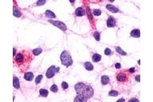 Anti-PTGFR antibody immunocytochemistry (ICC) staining of HEK293 human embryonic kidney cells transfected with PTGFR. (PTGFR antibody  (Extracellular Domain))