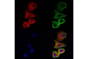 ABIN6259742 and ABIN6272985 staining Hela cells by IF/ICC.
