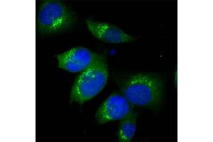 Human Melanoma cell line C 32 was cultured overnight on round cover slides placed in a 24 well tissue culture plate. (TGOLN2 antibody)