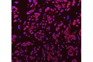 anti-Small Nuclear Ribonucleoprotein D3 Polypeptide 18kDa (SNRPD3) (AA 1-112) antibody