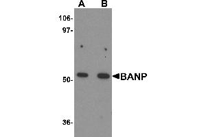 Western Blotting (WB) image for anti-Protein BANP (BANP) (Middle Region) antibody (ABIN1030879) (BANP antibody  (Middle Region))