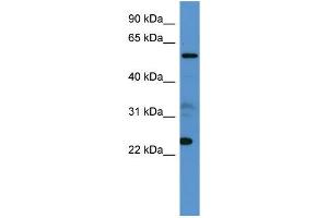 Human 721_B; WB Suggested Anti-CPNE9 Antibody Titration: 0.