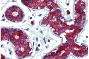 Human Breast (formalin-fixed, paraffin-embedded) stained with TPD52L1 antibody ABIN364314 at 5 ug/ml followed by biotinylated anti-mouse IgG secondary antibody ABIN481714, alkaline phosphatase-streptavidin and chromogen. (TPD52L1 antibody)