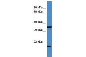 Western Blotting (WB) image for anti-TIMP Metallopeptidase Inhibitor 1 (TIMP1) (N-Term) antibody (ABIN2787966) (TIMP1 antibody  (N-Term))