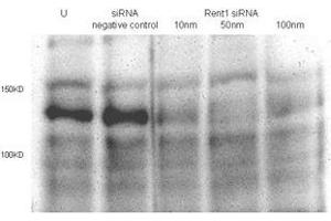 Total lysates (50ug per lane) from Hela cells untransfected (U) or transfected with negative siRNA control or Rent1 siRNAs of 10nm, 50nm to 100nm. (RENT1/UPF1 antibody  (AA 583-612))