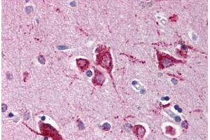 Human Brain, Cortex (formalin-fixed, paraffin-embedded) stained with RHEB antibody ABIN214467 at 5 ug/ml followed by biotinylated goat anti-rabbit IgG secondary antibody ABIN481713, alkaline phosphatase-streptavidin and chromogen. (RHEB antibody)