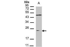 WB Image Sample(30 μg of whole cell lysate) A:293T 12% SDS PAGE antibody diluted at 1:1500 (VPS29 antibody  (C-Term))