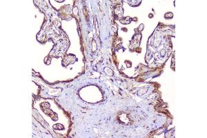 IHC analysis of RP2 using anti-RP2 antibody (ABIN6719513). (RP2 antibody  (AA 244-348))