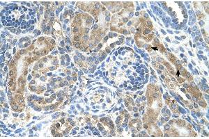 Human kidney (CRELD1 antibody  (C-Term))