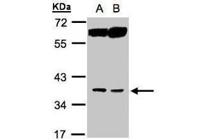 WB Image Sample(30 ug whole cell lysate) A:MOLT4 , B:Raji , 10% SDS PAGE antibody diluted at 1:1000 (ACOT8 antibody)