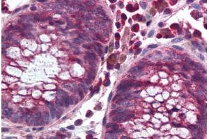 Human Colon (formalin-fixed, paraffin-embedded) stained with NOX1 antibody ABIN297329 at 10 ug/ml followed by biotinylated goat anti-rabbit IgG secondary antibody ABIN481713, alkaline phosphatase-streptavidin and chromogen. (NOX1 antibody  (C-Term))