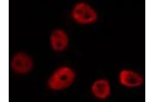 ABIN6275690 staining HUVEC by IF/ICC. (ZNF292 antibody  (Internal Region))