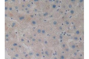 Detection of WNT3A in Human Liver Tissue using Polyclonal Antibody to Wingless Type MMTV Integration Site Family, Member 3A (WNT3A) (WNT3A antibody  (AA 1-290))