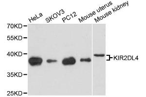 Western blot analysis of extracts of various cell lines, using KIR2DL4 antibody. (KIR2DL4/CD158d antibody  (AA 22-242))