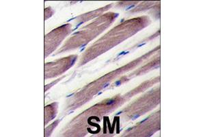 Formalin-fixed and paraffin-embedded human skeletal muscle tissue reacted with LATS2 polyclonal antibody  , which was peroxidase-conjugated to the secondary antibody, followed by DAB staining . (LATS2 antibody  (AA 195-224))
