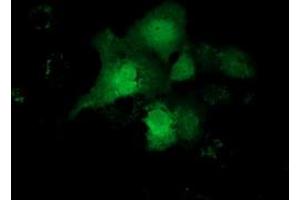 Anti-CBWD1 mouse monoclonal antibody (ABIN2452885) immunofluorescent staining of COS7 cells transiently transfected by pCMV6-ENTRY CBWD1 (RC222790). (CBWD1 antibody)