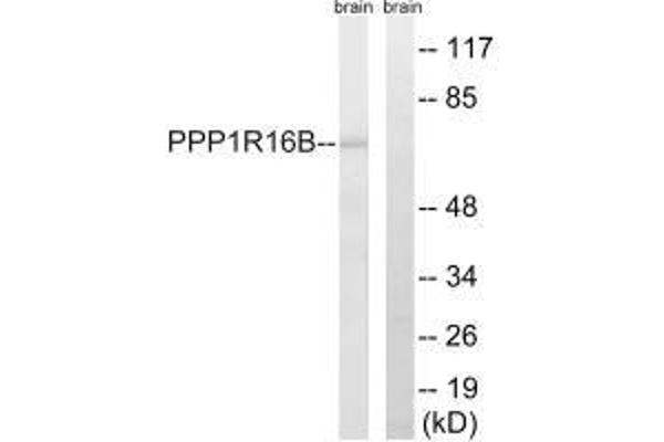 PPP1R16B antibody