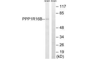 Western blot analysis of extracts from mouse brain cells, using PPP1R16B antibody. (PPP1R16B antibody)