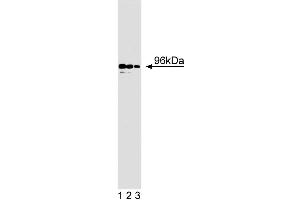 Western blot analysis of p96 on BC3H1 lysate. (DAB2 antibody  (AA 31-45))