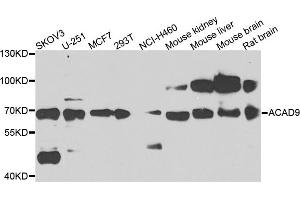 Western blot analysis of extracts of various cells, using ACAD9 antibody. (ACAD9 antibody)