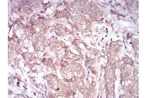 Immunohistochemistry (IHC) image for anti-ADP-Ribosylation Factor 1 (ARF1) (AA 76-182) antibody (ABIN5542481)