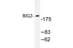Image no. 1 for anti-ADP-Ribosylation Factor Guanine Nucleotide-Exchange Factor 2 (Brefeldin A-Inhibited) (ARFGEF2) antibody (ABIN317822) (ARFGEF2 antibody)