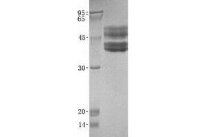 Validation with Western Blot (ST6GAL1 Protein (Transcript Variant 2))