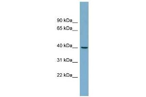 TRIM63 antibody used at 1 ug/ml to detect target protein. (TRIM63 antibody  (Middle Region))