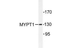 Image no. 1 for anti-Myosin Phosphatase, Target Subunit 1 (PPP1R12A) antibody (ABIN272043) (PPP1R12A antibody)