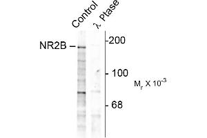 Western blots of rat hippocampal lysate showing specific immunolabeling of the ~180k NR2B subunit of the NMDAR phosphorylated at Tyr1252 (Control).