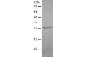 Carbonic Anhydrase VB, Mitochondrial (CA5B) (AA 34-317) protein (His-IF2DI Tag)