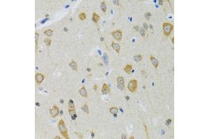 Immunohistochemistry of paraffin-embedded mouse brain using NEU1 antibody (ABIN5973721) at dilution of 1/100 (40x lens).