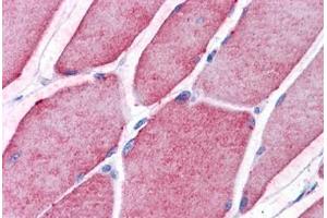 Human Skeletal Muscle: Formalin-Fixed, Paraffin-Embedded (FFPE) (TCTN2 antibody  (C-Term))