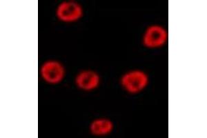 ABIN6279369 staining Hela by IF/ICC. (POLR1E antibody  (Internal Region))